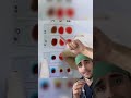Doctor explains: How to know your blood type?!🤯🤯
