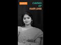 Causes Of Hair Loss Amrita Hospitals