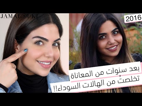 أسرع طريقة للتخلص من الهالات السوداء | لن تحتاجي إلى كريم للهالات السوداء هنا hana