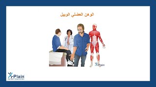 الوهن العضلي الوبيل
