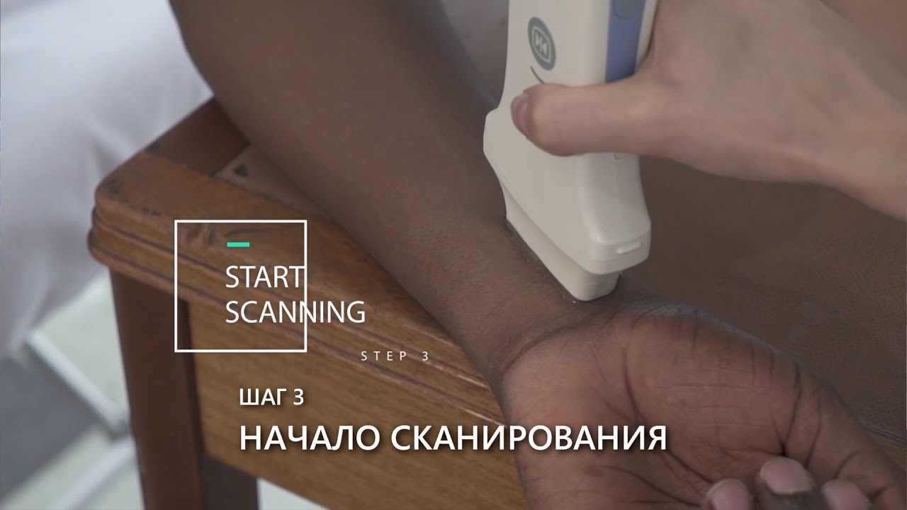 Постер видео