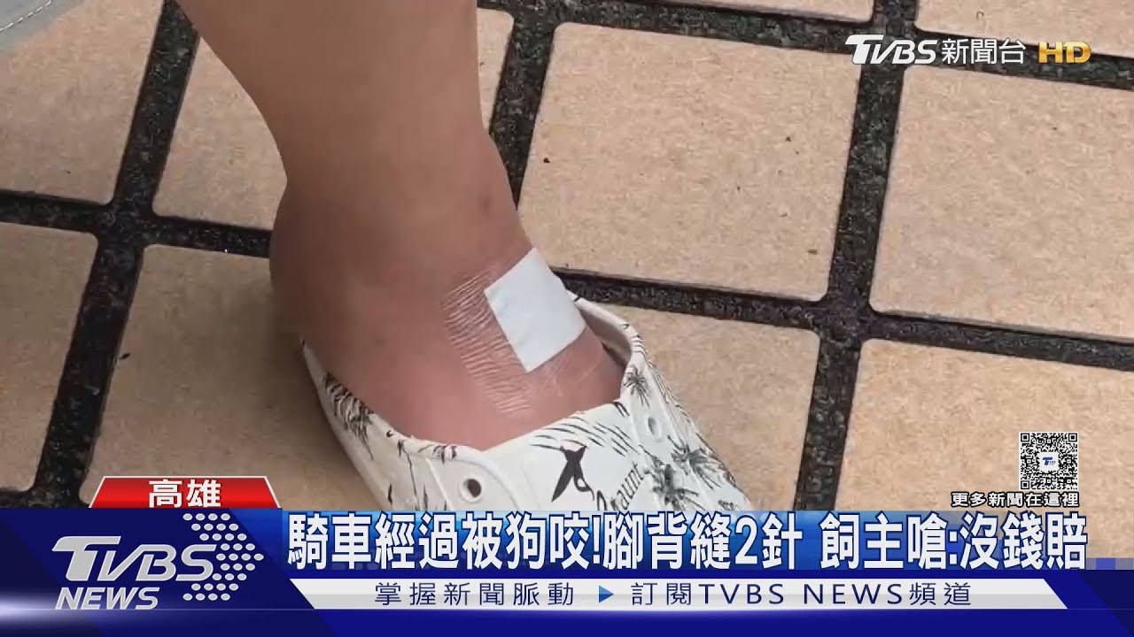 倒楣!騎車經過被狗咬 腳背縫2針 飼主竟嗆:「沒錢賠」