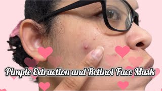 Pimple Extraction and Retinol Face Mask | Curly Cami Channel