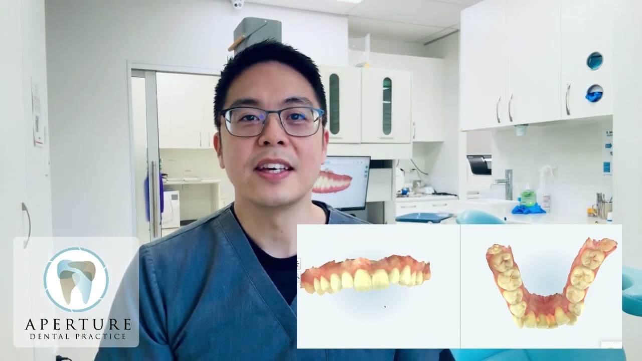 From Scan to Smile | Inside Your Clear Aligner Consultation