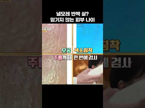 낼모레 반백 살 딸엄마의 피부 나이ㄷㄷ #순정시대 #피부관리 #shorts https://img.youtube.com/vi/nOeh9JWYuKE/0.jpg 낼모레 반백 살 딸엄마의 피부 나이ㄷㄷ #순정시대 #피부관리 #shorts