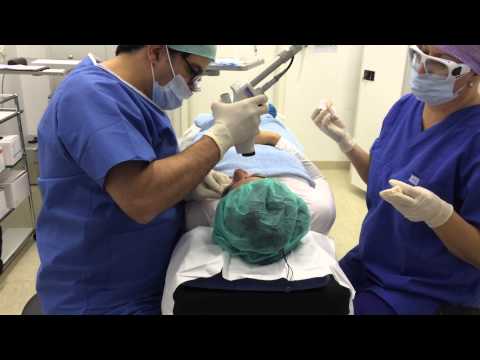 Fraktioneller CO2 - Laserbehandlung mit Ultrapulse Encore Lumenis