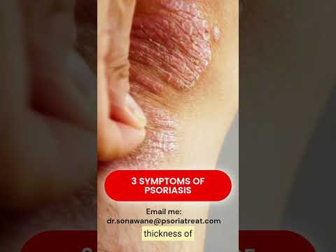 3 Key Psoriasis Symptoms You Need to Watch For