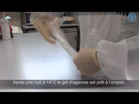 Immunodiffusion en gélose (IDG)