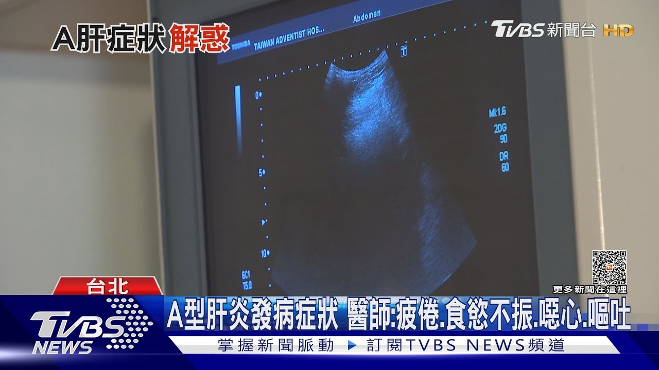 注意!出現「這幾種」症狀恐罹A型肝炎 醫師:速就醫檢查