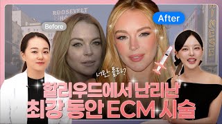 최강 동안 ECM시술, 리투오가 진짜 대세인 이유 (원리까지 싹 설명!)