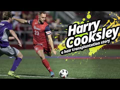 HARRY  COOKSLEY   |      HAIR TRANSPLANTATION TURKEY  |   ESTEPERA HAIR CLINIC