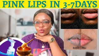 HOW TO MAKE PINK LIPS NATURALLY & PERMANENTLY AT HOME In 7 DAYS | DIY Scrubs For Lips | Simply Shuga