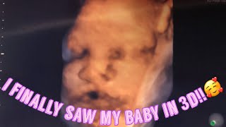 TEEN PREGNANCY 3D ULTRASOUND AT 37 WEEKS !!💓💓💓|PREGNANT AT 15