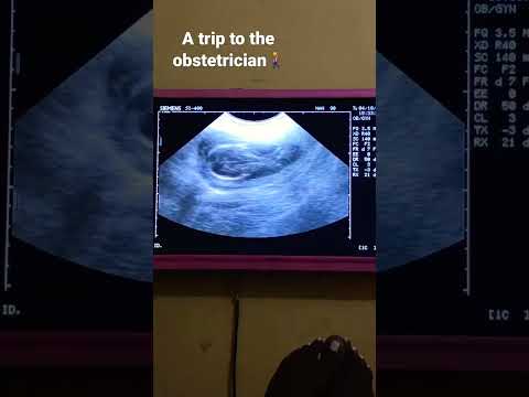 19 weeks pregnancy scan 🤩