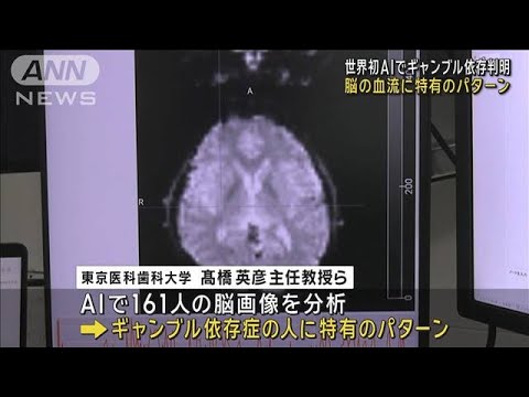世界初　AIでギャンブル依存判明　脳の血流に特有のパターン(2024年5月6日)