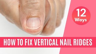 10 Ways To Get Rid of Vertical Ridges On Nails as Per Dermatologist