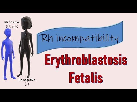 Rh incompatibility II Erythroblastosis fetalis II Prevention with Rhogam