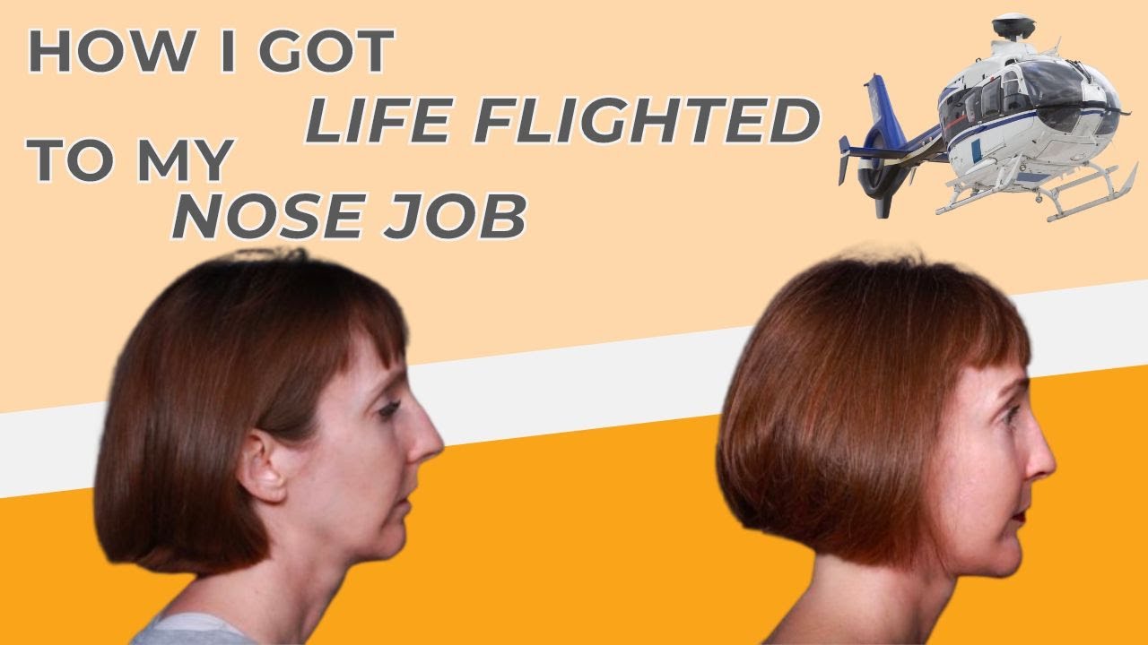 Patient Kathleen: How I Got Life Flighted To My Nose Job