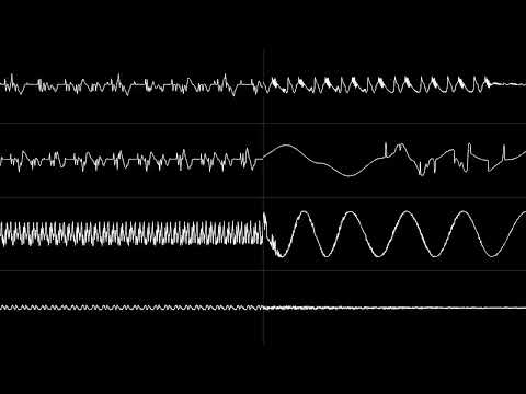 Yousuke Yasui - Massive X (YM2414)