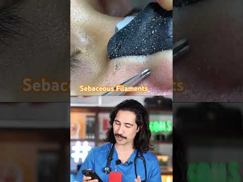 Pore Strips Doctor Reacts #porestrips #skincare #skin