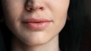 What can be done for brown burn marks on face due to hot wax? - Dr. Surindher D S A