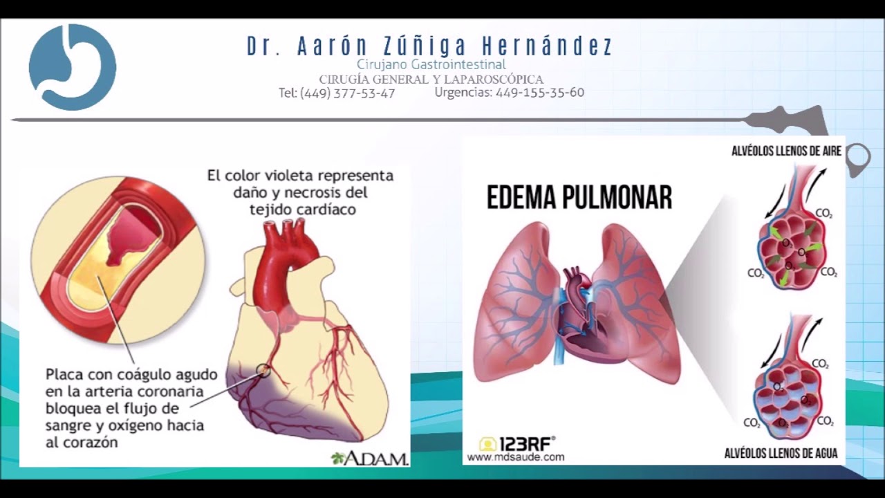 Aarón Zúñiga Hernández-12