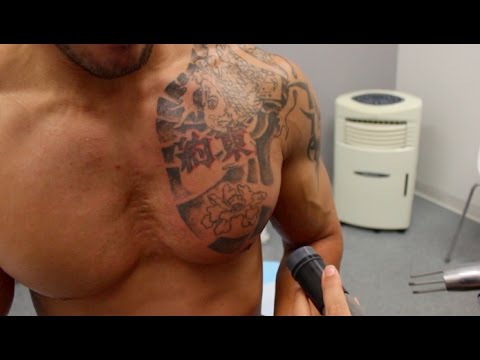 download lagu mp3 mp4 50 Cent Tattoo Removal Scars, download lagu 50 Cent Tattoo Removal Scars gratis, unduh video klip 50 Cent Tattoo Removal Scars