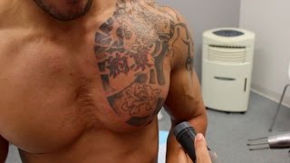 THE TATTOO REMOVAL PROCESS