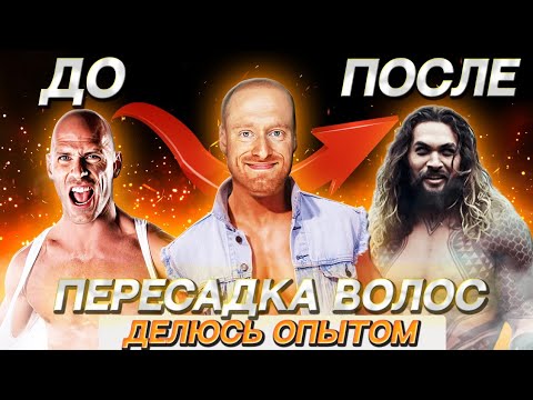 Пересадка волос. Как выйти на улицу на 4 день прсле пересадки.