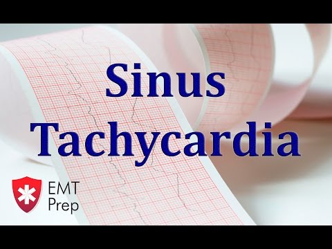 Sinus Tachycardia ECG - EMTprep.com