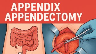 Appendix , Appendectomy , Surgery Lecture # 47 By Dr. Abdullah 
