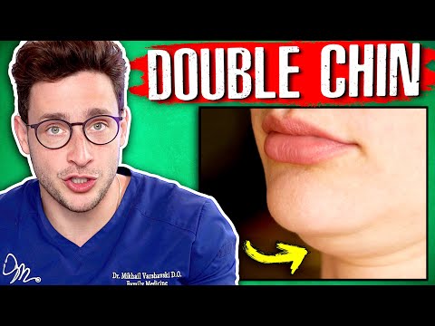 How To Get Rid Of A Double Chin? | Responding To Your Comments Ep. 20