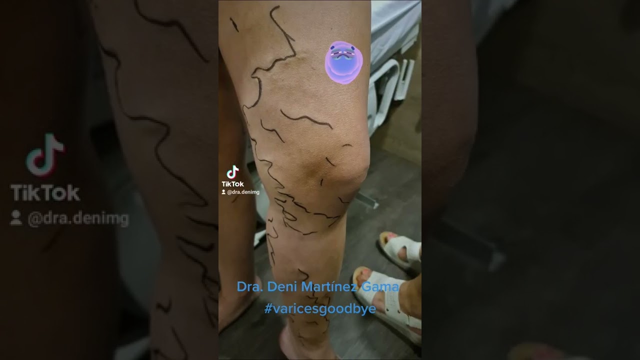 Deni Martínez Gama-21