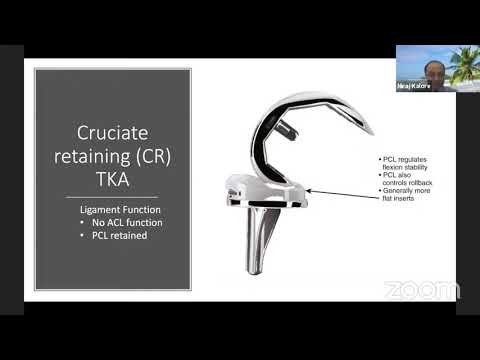 Implant design in Total Knee Replacement