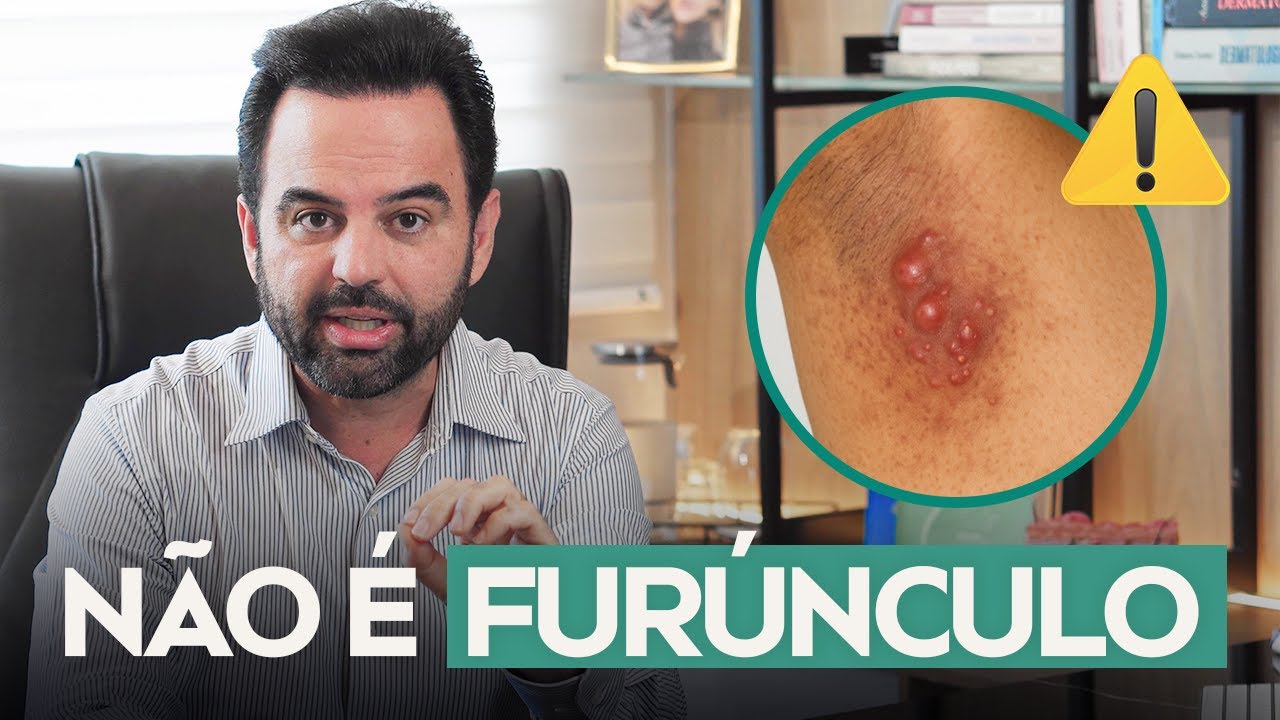 Dr. Maurício Conti — vídeo 6
