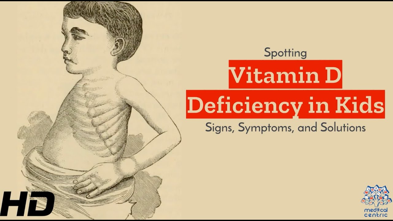 Vitamin D Deficiency in Kids: Navigating the Challenges
