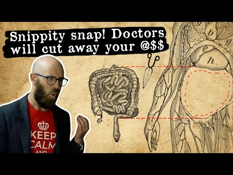 Removing Butts: The Bizarre Early 20th Century Obsession with Removing Random Body Parts