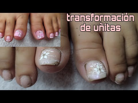 TRANSFORMACIÓN de uñas 💅/ pedicura /gel semipermanente+3D 😍#naildesing