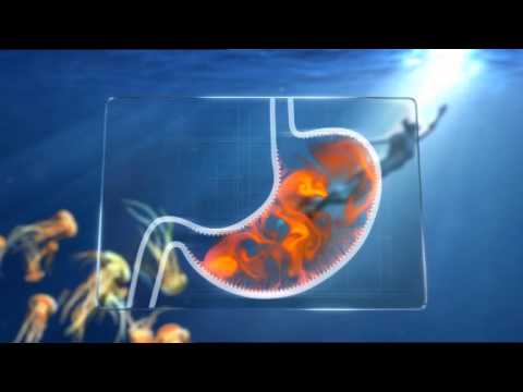 Ta Kontroll over tilbakevendende halsbrann - www.somac.no -