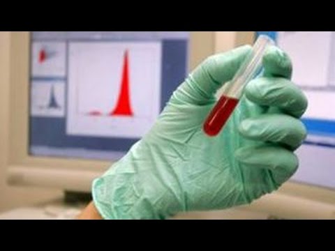 High potassium levels: Should I Worry?