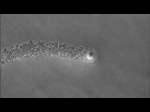Deformando osteoartrite delle articolazioni dellanca trattamento 2 gradi Come prendere una doccia con osteocondrosi