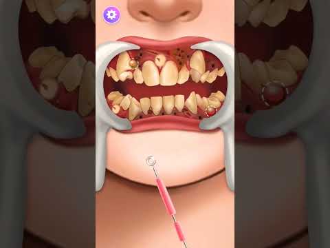 teeth part 2 #cleaning #trending #viral #clean #leg #teeth