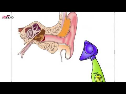 Këshilla mjekësore - ilaçet natyrore për dhimbjen e veshit