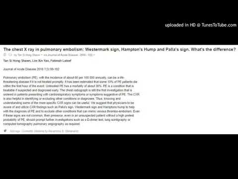 The chest X ray in pulmonary embolism: Westermark sign, Hampton's Hump and Palla's sign. What's the