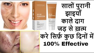 Best cream for Pigmentation,  Blemishes and Dark Spots | Jhaiyo ki Best Cream | Dermatouch