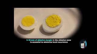 2025 APSCVIR Optimizing Liver Ablation: Practical Tips  for Enhanced Efficacy and Safety (Live)