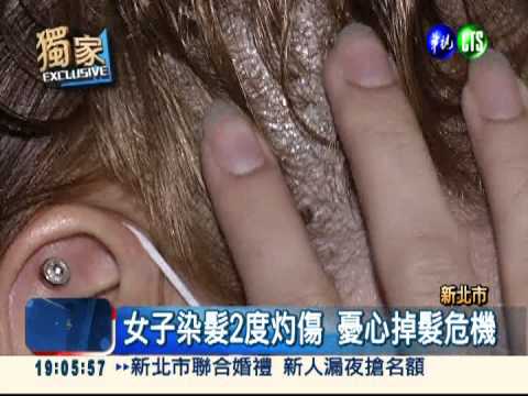 髮廊擅自漂髮 害女客頭皮灼傷