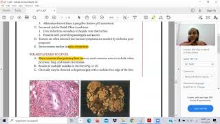 GIT 6 - Pathology B  -Ibrahem Gamal - Toxic usmle - شرح المعادلة الامريكية بالعربي