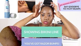 Razor Bumps &amp; Ingrown: How to get rid of / prevent razor bumps &amp; ingrown hairs