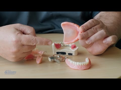 Dentures and Partial Dentures Brisbane - Teeth Replacement Options